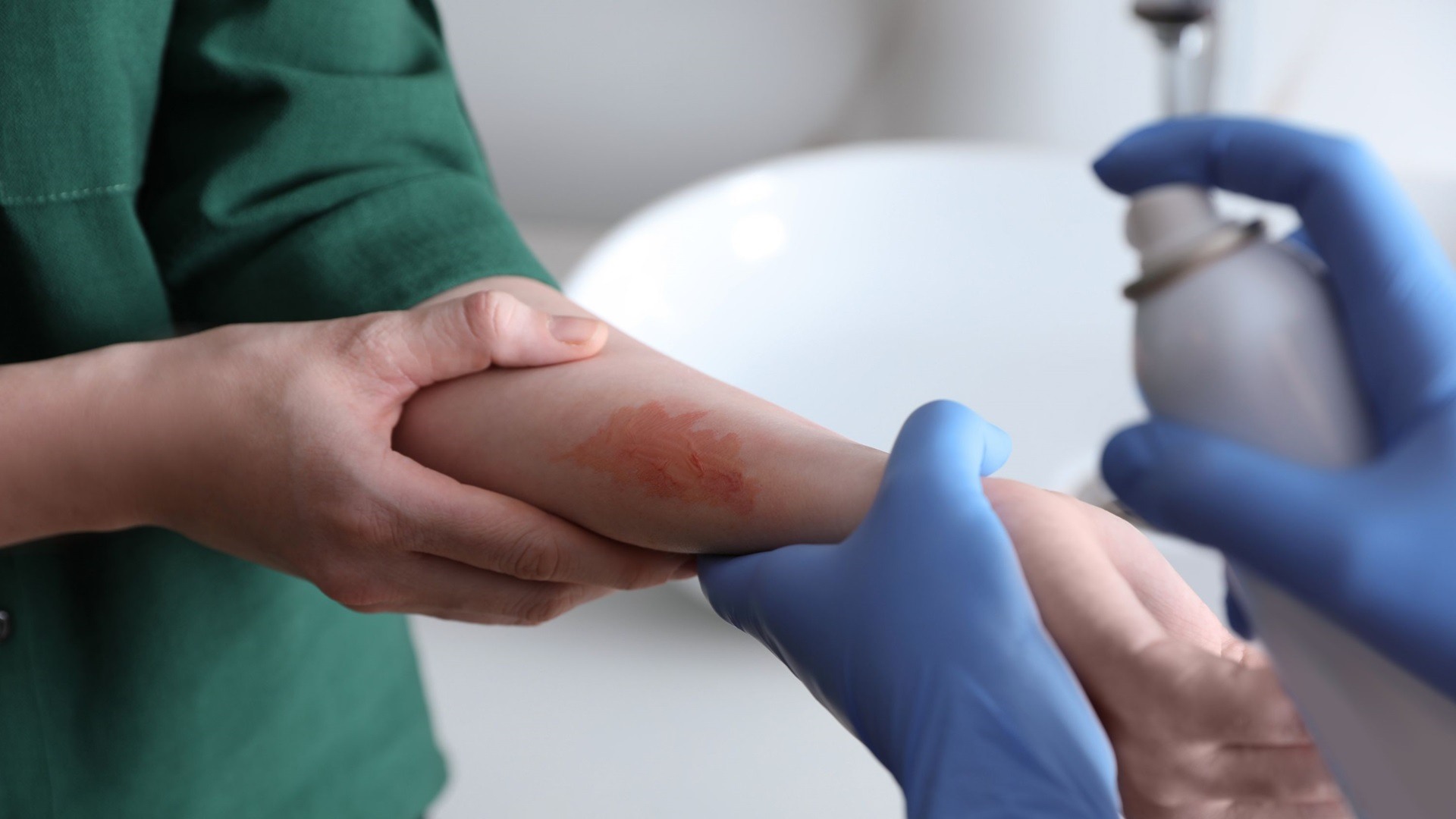 First aid for burns and serious injuries